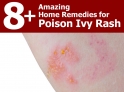 home-remedies-for-poison-ivy-rash-1024x768